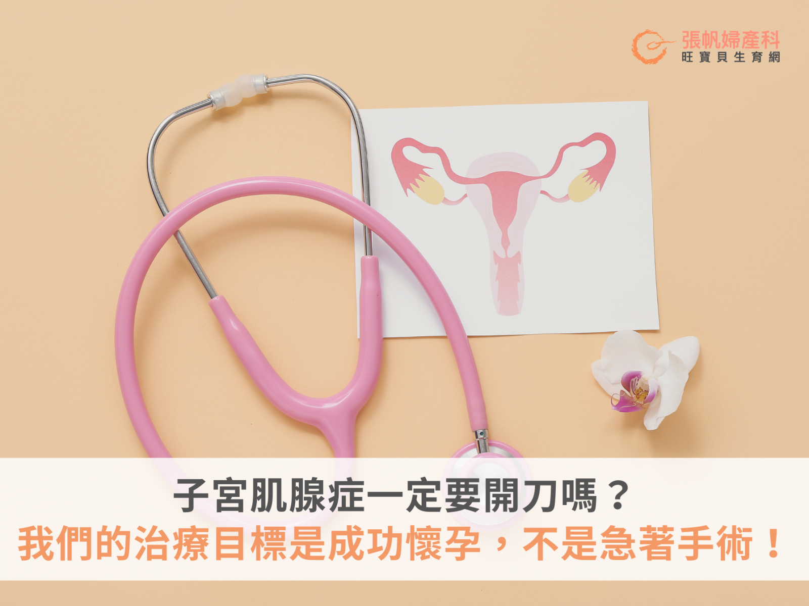 張帆婦產科｜子宮肌腺症一定要開刀嗎？我們的治療目標是成功懷孕，不是急著手術！