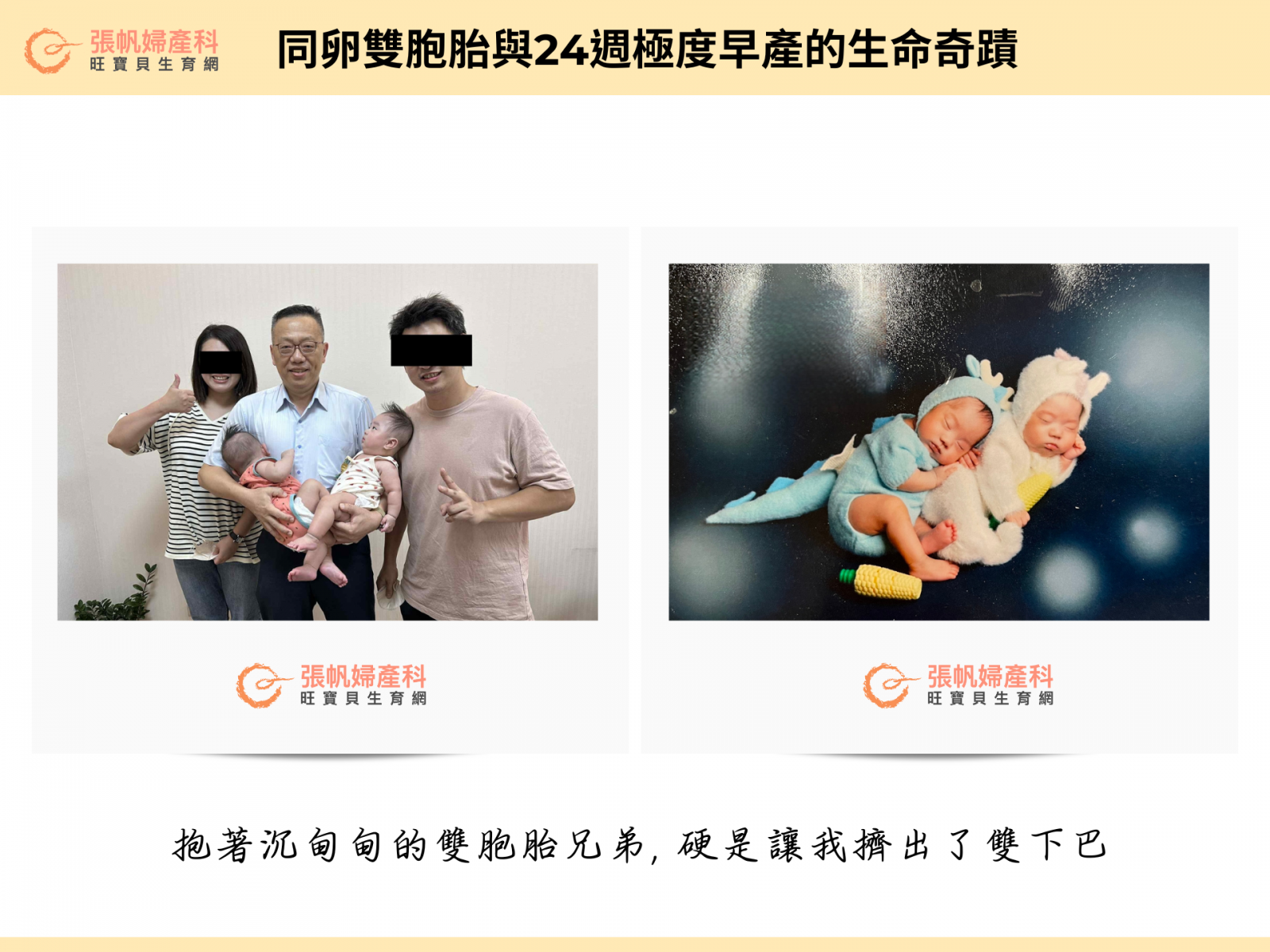 張帆婦產科｜同卵雙胞胎與24週極度早產的生命奇蹟