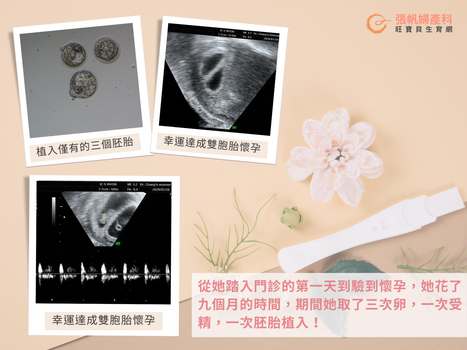 張帆婦產科｜病人成功率為首要，冷凍卵子、調整卵子精子品質，讓病人一次胚胎植入就成功懷孕！