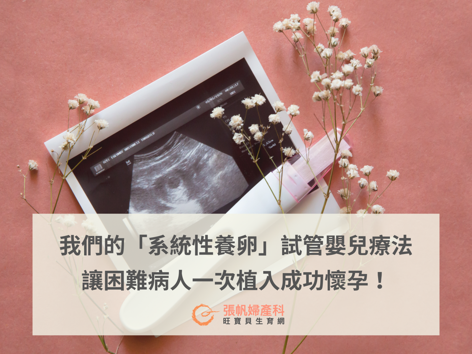 張帆婦產科｜我們的「系統性養卵」試管嬰兒療法，讓困難病人一次植入成功懷孕