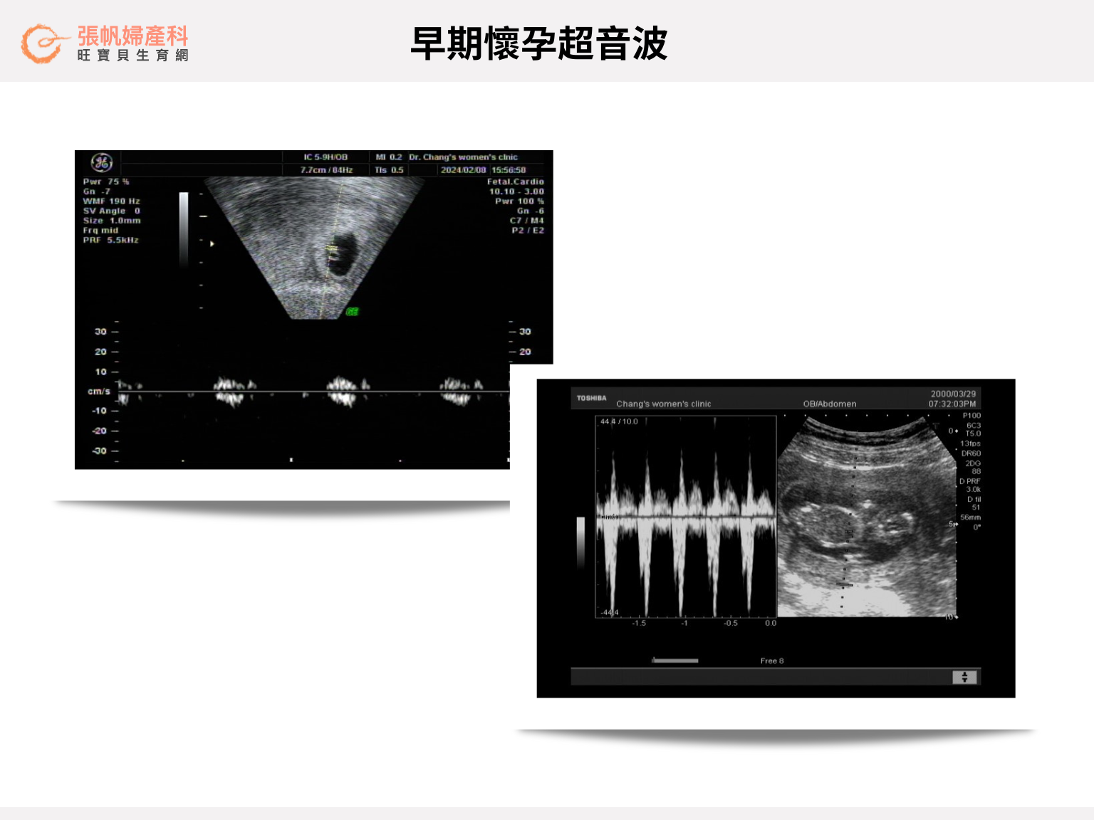 張帆婦產科|以 42 歲之齡,成功生下了寶寶,完成了近四年艱苦的求孕生育過程