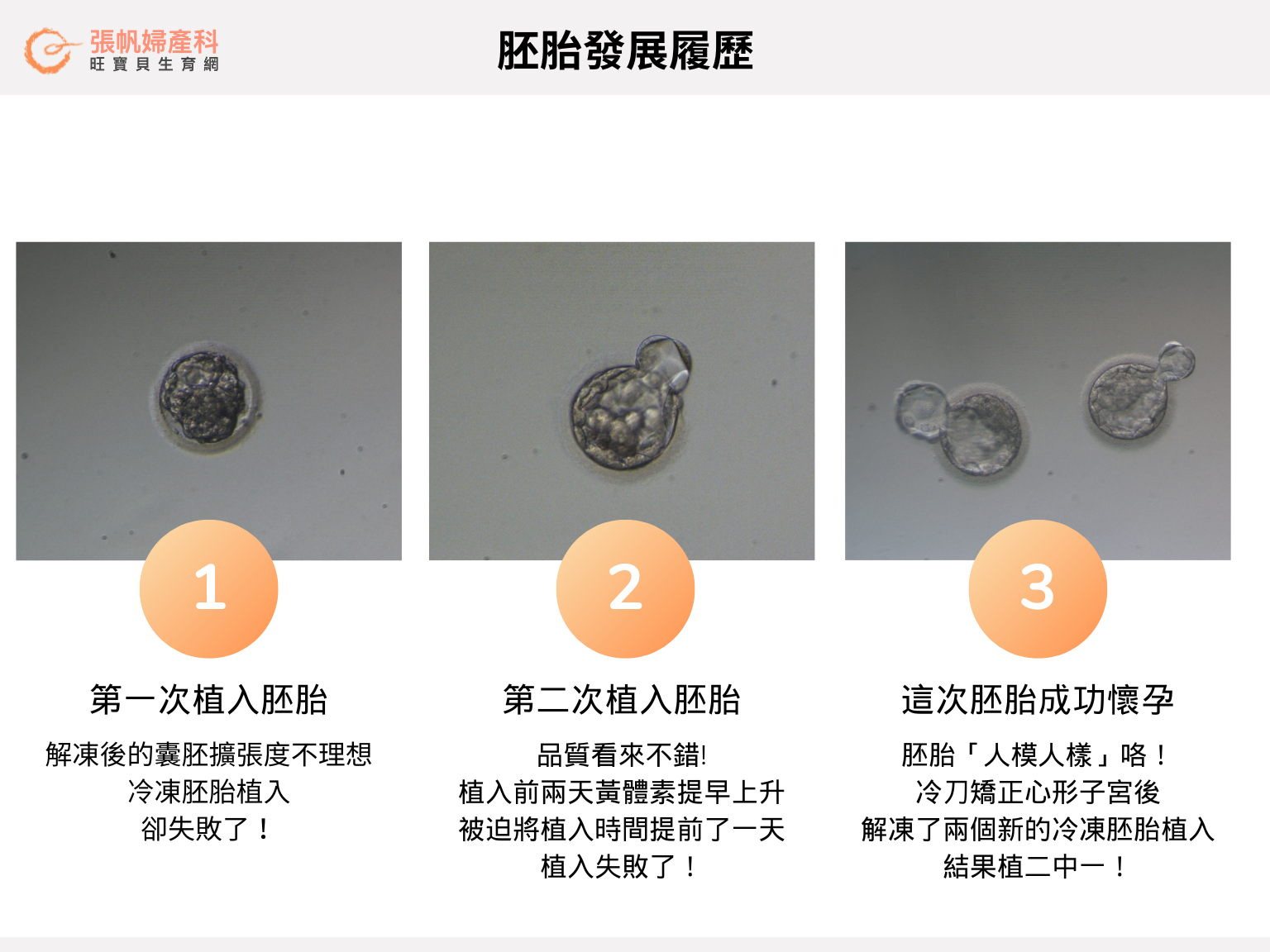 張帆婦產科|胚胎發展履歷