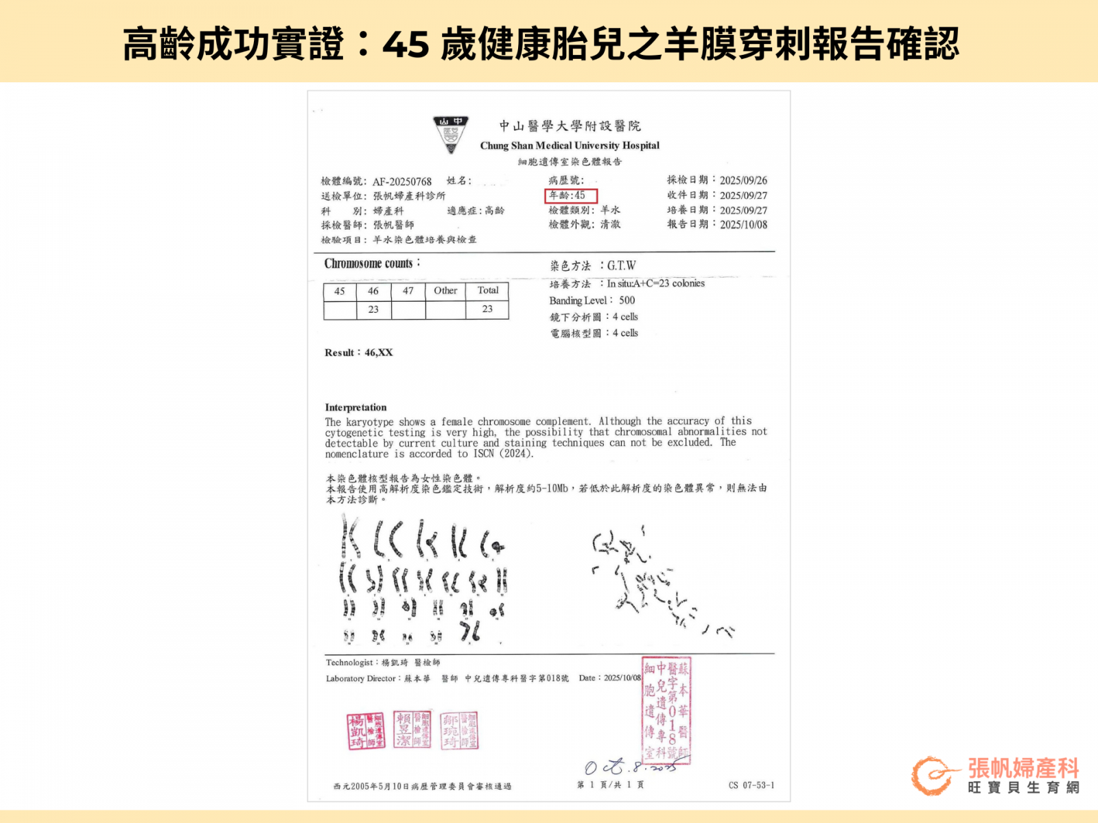 張帆婦產科|高齡成功實證:45 歲健康胎兒之羊膜穿刺報告確認