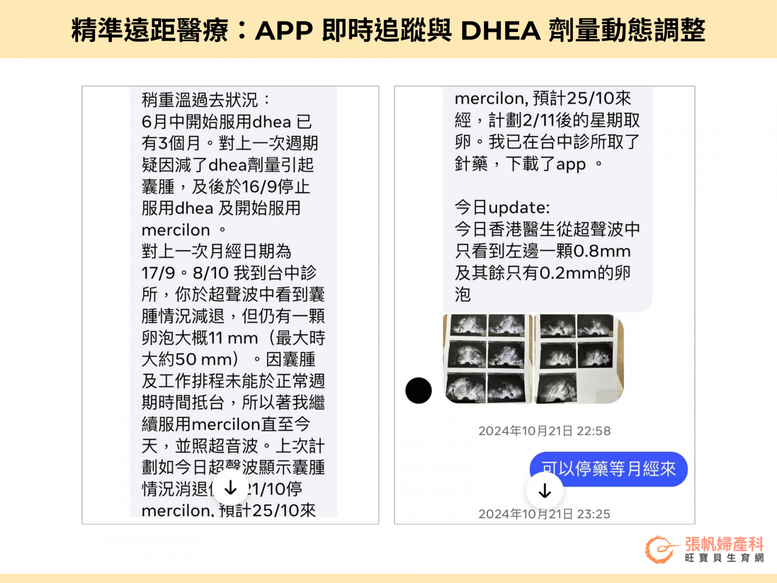張帆婦產科|精準遠距醫療:APP 即時追蹤與 DHEA 劑量動態調整