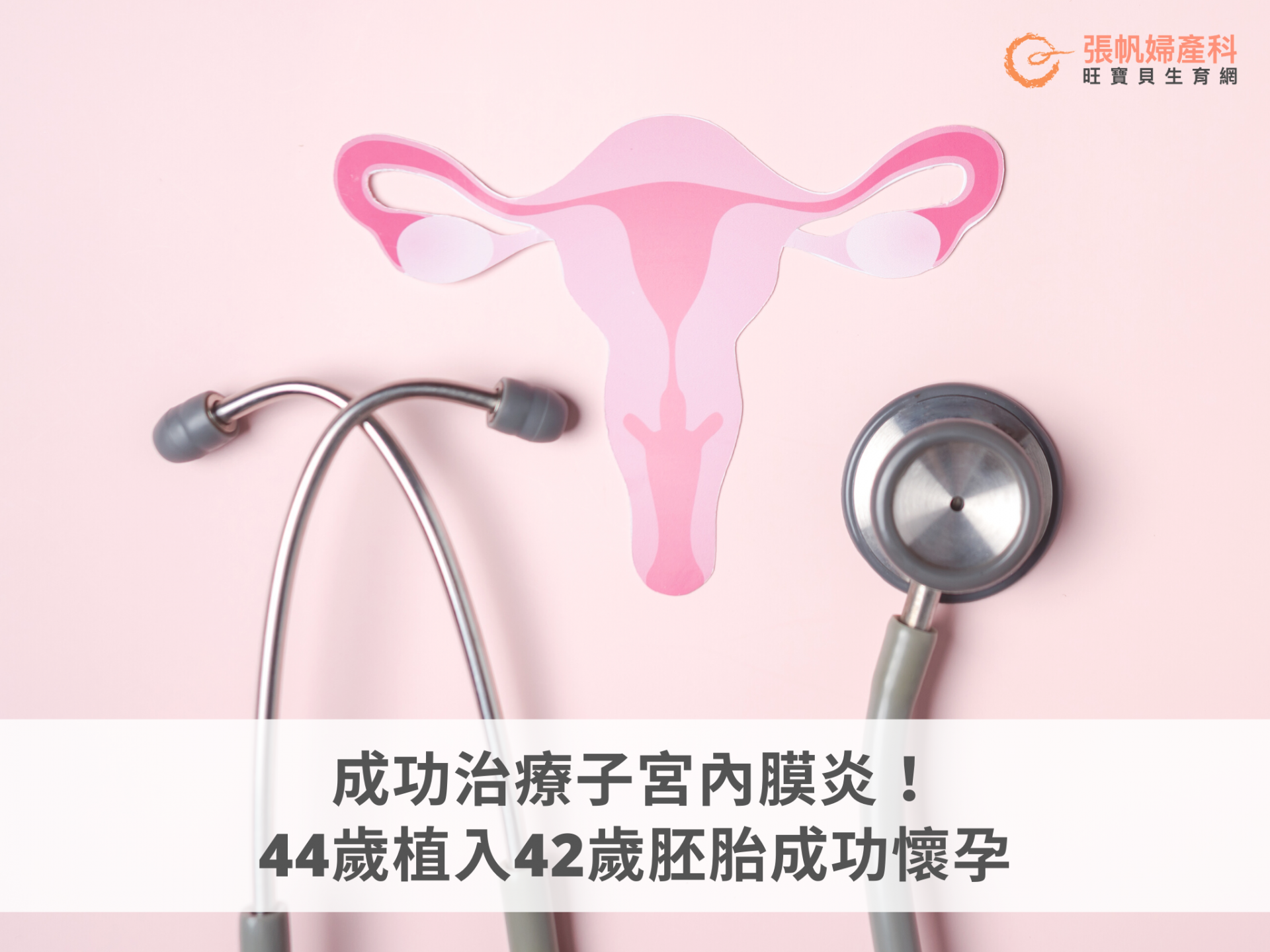 張帆婦產科｜成功案例：成功治療子宮內膜炎，44歲植入42歲胚胎成功懷孕-張帆婦產科